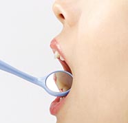 インプラントで健康な歯を